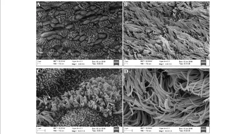 기관지 섬모의 전자 현미경 사진